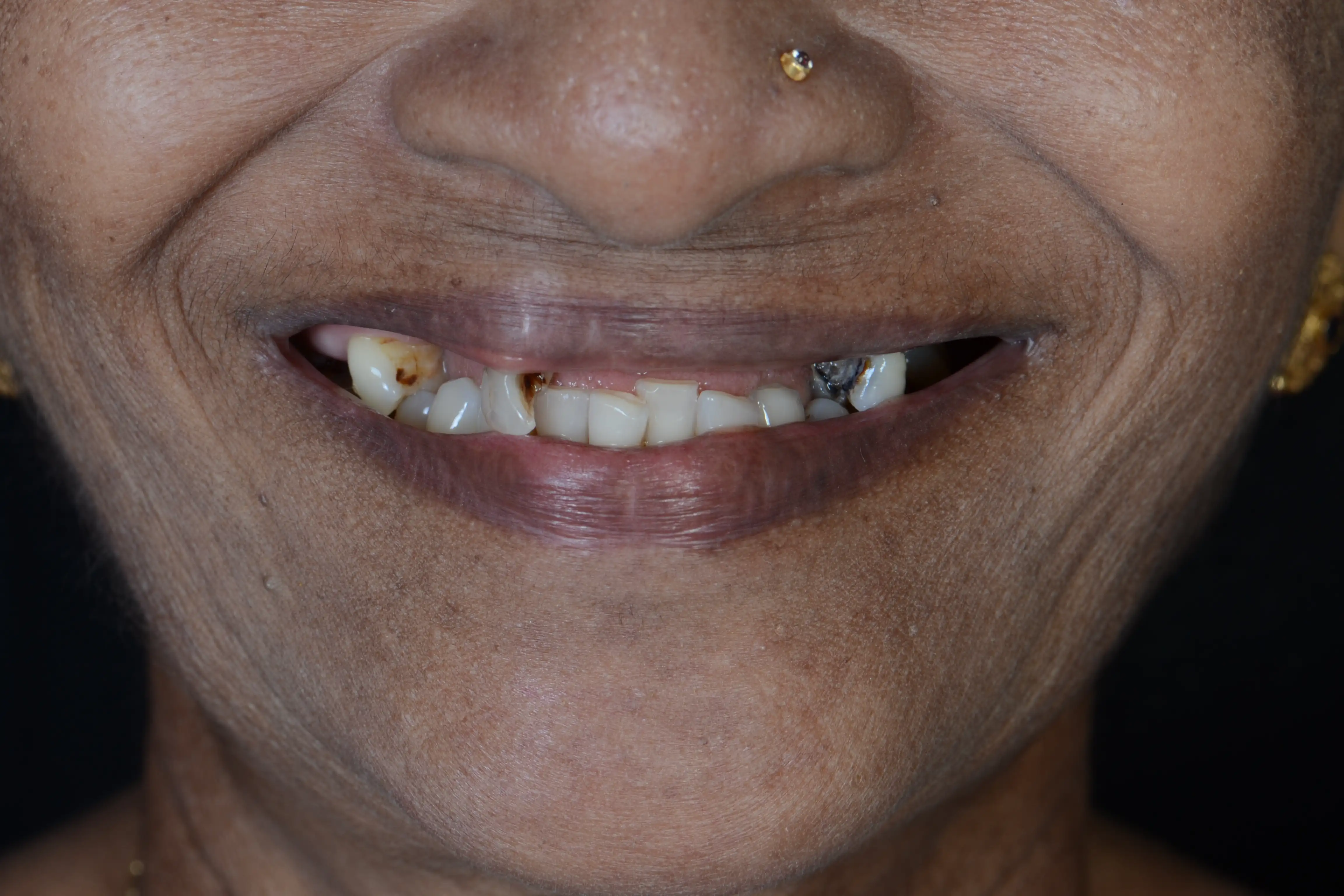 Before treatment